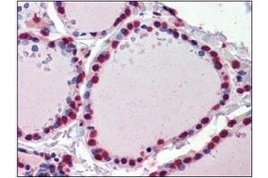 Immunohistochemistry (IHC) image for anti-Cellular Retinoic Acid Binding Protein 1 (CRABP1) (AA 1-137), (N-Term) antibody (ABIN400870) (CRABP1 抗体  (N-Term))