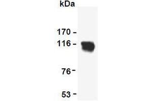 Western Blotting (WB) image for anti-Reversion-Inducing-Cysteine-Rich Protein with Kazal Motifs (RECK) (AA 621-832) antibody (ABIN1108847) (RECK 抗体  (AA 621-832))