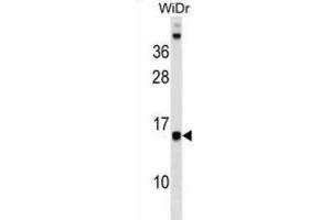 Western Blotting (WB) image for anti-Defender Against Cell Death 1 (DAD1) antibody (ABIN2999454) (DAD1 抗体)