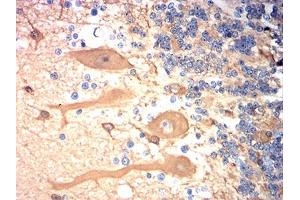 Immunohistochemical analysis of paraffin-embedded cerebellum tissues using TUBB3 mouse mAb with DAB staining. (TUBB3 抗体)