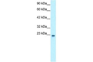 Human HepG2; WB Suggested Anti-GTF2F2 Antibody Titration: 0. (GTF2F2 抗体  (Middle Region))