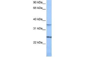 WB Suggested Anti-PIGF Antibody Titration:  0.