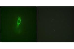 Immunofluorescence analysis of NIH-3T3 cells, using ETK (Phospho-Tyr40) Antibody. (BMX 抗体  (pTyr40))