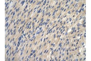 Rabbit Anti-TRIantibody        Paraffin Embedded Tissue:  Human Heart cell   Cellular Data:  Epithelial cells of renal tubule  Antibody Concentration:   4. (TRIP13 抗体  (N-Term))