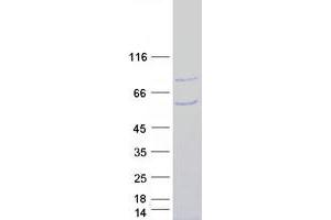 Western Blotting (WB) image for SMAD Specific E3 Ubiquitin Protein Ligase 1 (SMURF1) (Transcript Variant 2) protein (Myc-DYKDDDDK Tag) (ABIN2732267)