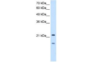 WB Suggested Anti-MMP7 Antibody Titration:  2. (MMP7 抗体  (C-Term))