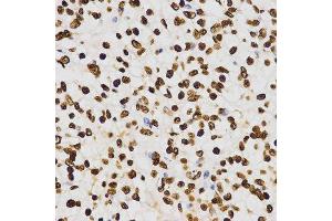 Immunohistochemistry (IHC) image for anti-Histone H3 (H3) (H3K27me) antibody (ABIN3023266) (Histone 3 抗体  (H3K27me))