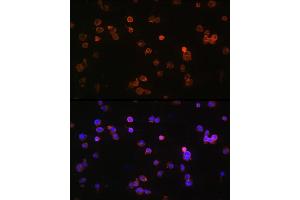 Immunofluorescence analysis of Jurkat cells using P2RX5 Rabbit pAb (ABIN6132450, ABIN6145117, ABIN6145118 and ABIN6215403) at dilution of 1:100 (40x lens). (P2RX5 抗体  (AA 341-422))