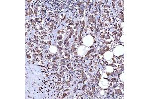 IHC analysis of RAB3GAP1 using anti-RAB3GAP1 antibody (ABIN7599702).