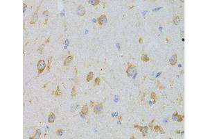 Immunohistochemistry of paraffin-embedded Mouse brain using KISS1R Polyclonal Antibody at dilution of 1:100 (40x lens). (KISS1R 抗体)