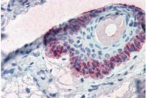 Human Skin, Hair Follicle (formalin-fixed, paraffin-embedded) stained with KRT15 antibody ABIN334263 at 5 ug/ml followed by biotinylated anti-mouse IgG secondary antibody ABIN481714, alkaline phosphatase-streptavidin and chromogen.