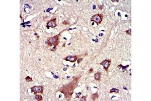 |Immunohistochemistry of paraffin-embedded human brain cancer tissue using GSNantibody. (Gelsolin 抗体  (C-Term))