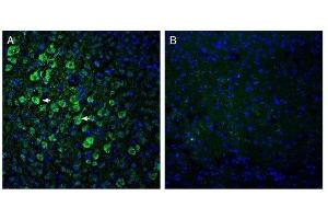 Expression of ADAM10 in mouse parietal cortex. (ADAM10 抗体  (Extracellular, N-Term))