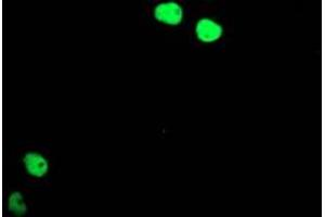 Image no. 3 for anti-T-Cell Acute Lymphocytic Leukemia 1 (TAL1) antibody (ABIN1501289) (TAL1 抗体)