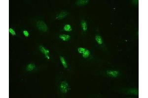 IF analysis of HMGB2 using anti-HMGB2 antibody (ABIN4886620). (HMGB2 抗体  (N-Term))