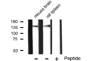 Western blot analysis of VEGFR1 expression in mouse brain and rat spleen tissue lysates,The lane on the right is treated with the antigen-specific peptide. (FLT1 抗体)