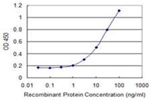 Detection limit for recombinant GST tagged DCK is 0. (DCK 抗体  (AA 161-260))