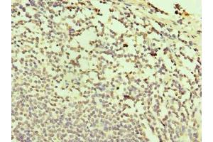 Immunohistochemistry of paraffin-embedded human small intestine tissue using ABIN7171996 at dilution of 1:100 (TXNDC11 抗体  (AA 656-985))