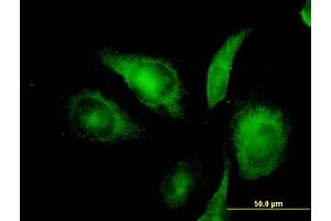Immunofluorescence of monoclonal antibody to NIFUN on HeLa cell. (ISCU 抗体  (AA 26-167))