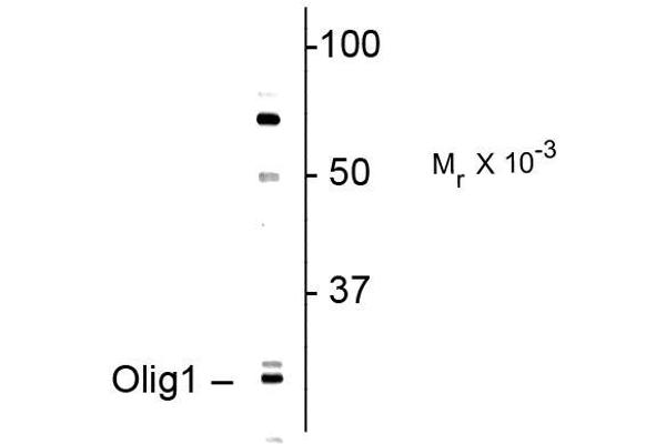 OLIG1 抗体