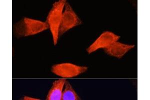 Immunofluorescence analysis of HeLa cells using PSAT1 Polyclonal Antibody at dilution of 1:100 (40x lens). (PSAT1 抗体)