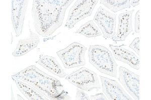 Immunohistochemistry (IHC) image for anti-Kruppel-Like Factor 4 (Gut) (KLF4) (AA 75-125) antibody (ABIN7795639) (Recombinant KLF4 抗体  (AA 75-125))