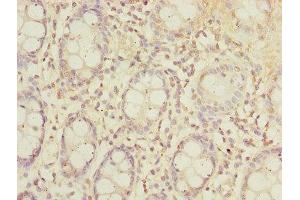 Immunohistochemistry (IHC) image for anti-Solute Carrier Family 23 (Nucleobase Transporters), Member 2 (SLC23A2) (AA 1-90) antibody (ABIN7170174)