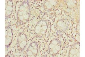 Immunohistochemistry of paraffin-embedded human colon tissue using ABIN7170174 at dilution of 1:100 (SLC23A2 抗体  (AA 1-90))