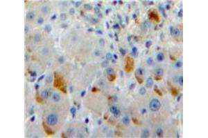 Used in DAB staining on fromalin fixed paraffin-embedded Liver tissue (SIGLEC7 抗体  (AA 381-467))