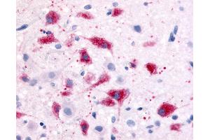 Immunohistochemistry (IHC) image for anti-Corticotropin Releasing Hormone Receptor 1 (CRHR1) (N-Term) antibody (ABIN1048461)