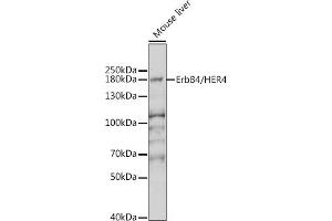 Western blot analysis of extracts of mouse brain, using ErbB4/HER4 antibody (ABIN6131263, ABIN6140257, ABIN6140260 and ABIN6221732) at 1:1000 dilution. (ERBB4 抗体  (AA 26-160))