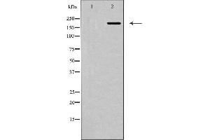 Western blot analysis of MYLK expression in HepG2 cells. (MYLK 抗体  (C-Term))