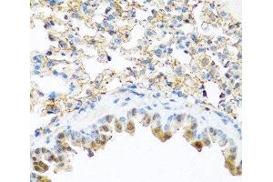 Immunohistochemistry of paraffin-embedded Mouse lung using PI3 Polyclonal Antibody at dilution of 1:100 (40x lens). (PI3 抗体)