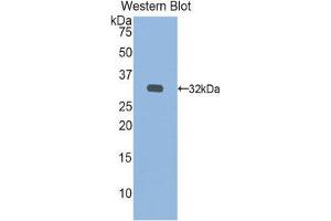 Western Blotting (WB) image for anti-Iduronate 2-Sulfatase (IDS) (AA 180-448) antibody (ABIN1859253)