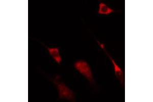 ABIN6274323 staining HT29 cells by IF/ICC.