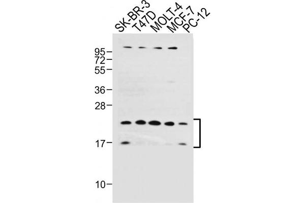UBE2W 抗体  (C-Term)
