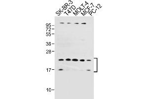 All lanes : Anti-UBE2W Antibody (C-term) at 1:1000 dilution Lane 1: SK-BR-3 whole cell lysate Lane 2: T47D whole cell lysate Lane 3: MOLT-4 whole cell lysate Lane 4: MCF-7 whole cell lysate Lane 5: PC-12 whole cell lysate Lysates/proteins at 20 μg per lane. (UBE2W 抗体  (C-Term))