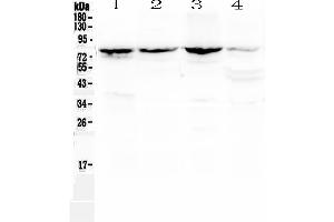Western blot analysis of Calpain 2 using anti-Calpain 2 antibody . (Calpain 2 抗体  (AA 500-700))