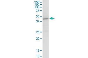 ACADM MaxPab rabbit polyclonal antibody. (Medium-Chain Specific Acyl-CoA Dehydrogenase, Mitochondrial (AA 1-421) 抗体)