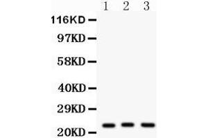 Western Blotting (WB) image for anti-Peroxiredoxin 5 (PRDX5) (AA 66-198) antibody (ABIN3043906) (Peroxiredoxin 5 抗体  (AA 66-198))