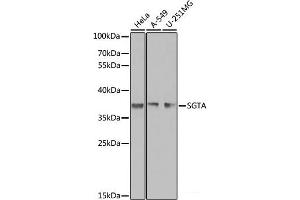 Western blot analysis of extracts of various cell lines using SGTA Polyclonal Antibody at dilution of 1:1000. (SGTA 抗体)