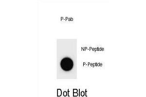 Dot blot analysis of Mouse p21Cip1 Antibody (Phospho ) Phospho-specific Pab (ABIN1881616 and ABIN2837842) on nitrocellulose membrane. (p21 抗体  (pSer125))
