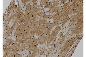 ABIN6262804 and ABIN6273130 at 1/100 staining Mouse heart tissue by IHC-P.