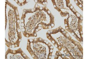 Immunostaining (ISt) image for anti-TRAF3 Interacting Protein 2 (TRAF3IP2) (AA 451-565) antibody (ABIN564691)