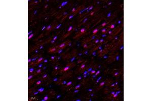 Immunofluorescence (Paraffin-embedded Sections) (IF (p)) image for anti-Nuclear Apoptosis Inducing Factor 1 (NAIF1) antibody (ABIN7074867)