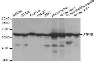 Western blot analysis of extracts of various cell lines, using ATP5B antibody. (ATP5B 抗体)