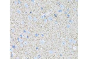 Immunohistochemistry of paraffin-embedded Mouse brain using ATP1B2 Polyclonal Antibody at dilution of 1:100 (40x lens). (ATP1B2 抗体)