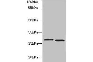 Western blot All lanes: CRYBB1 antibody at 1. (CRYBB1 抗体  (AA 1-252))