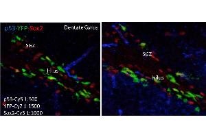 Immunofluorescence (IF) image for anti-Tumor Protein P53 (TP53) antibody (ABIN105263)