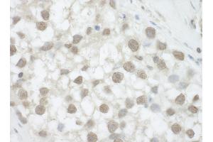 Immunohistochemistry (IHC) image for anti-DEAH (Asp-Glu-Ala-His) Box Polypeptide 36 (DHX36) (C-Term) antibody (ABIN7449716)